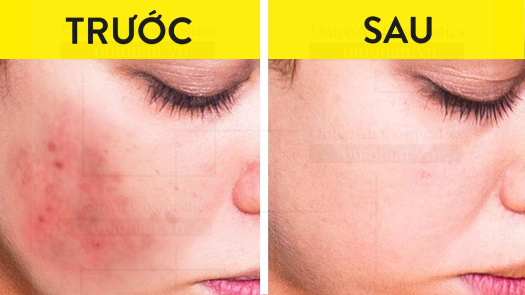 Sữa Rửa Mặt Chiết Xuất Từ Trà Xanh 3W Clinic Green Tea Cleansing Foam